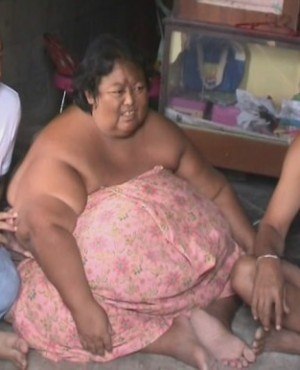 โรคอ้วน