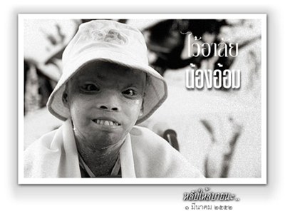 น้องอ้อม เด็กดักแด้