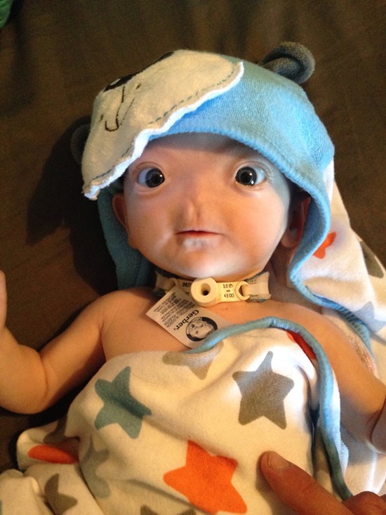 หนูน้อยผู้เกิดมาไร้จมูก หนูน้อยผู้เกิดมาไร้จมูก