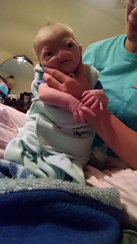 หนูน้อยผู้เกิดมาไร้จมูก หนูน้อยผู้เกิดมาไร้จมูก