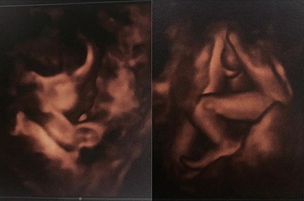 ฌอห์ณ เผยข่าวดี พลอย จินดาโชติ ฌอห์ณ เผยข่าวดี พลอย จินดาโชติ