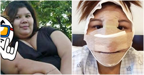 ศัลยกรรมเปลี่ยนชีวิต ศัลยกรรมเปลี่ยนชีวิต