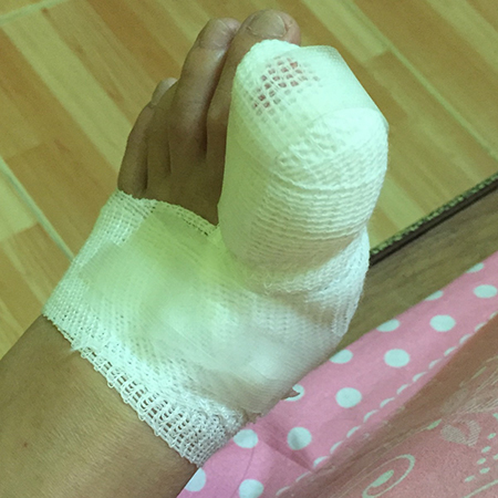 ตัดเล็บผิดวิธี ตัดเล็บผิดวิธี