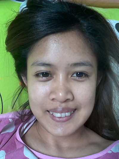 รีวิวจัดฟัน รีวิวจัดฟัน