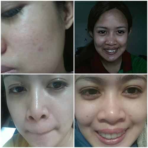 รีวิวจัดฟัน รีวิวจัดฟัน