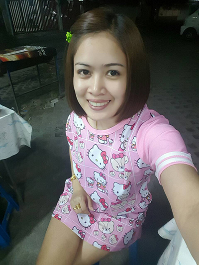 รีวิวจัดฟัน รีวิวจัดฟัน