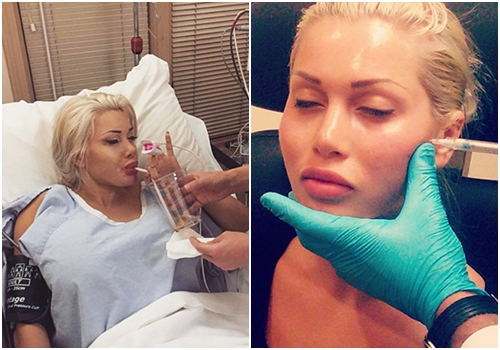 สาวตัดซี่โครง 6 ซี่ สาวตัดซี่โครง 6 ซี่