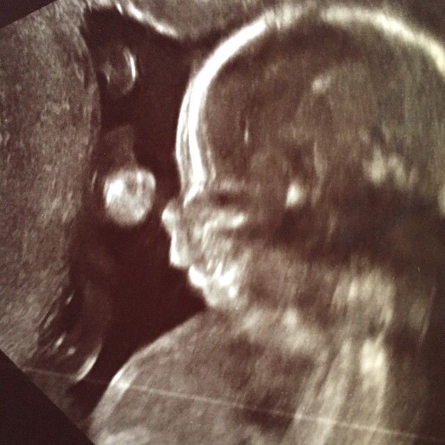 เจนนี่ อั๋น เจนนี่ อั๋น