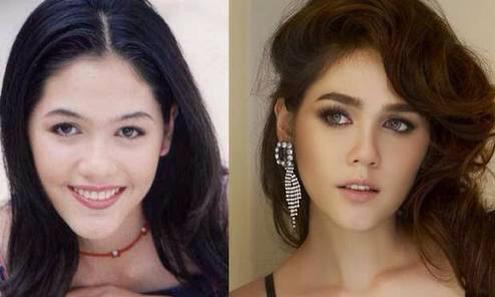 ชมพู่ อารยา ศัลยกรรม ชมพู่ อารยา ศัลยกรรม