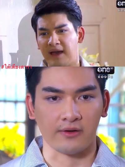 สิงโต เดอะสตาร์ ศัลยกรรม สิงโต เดอะสตาร์ ศัลยกรรม