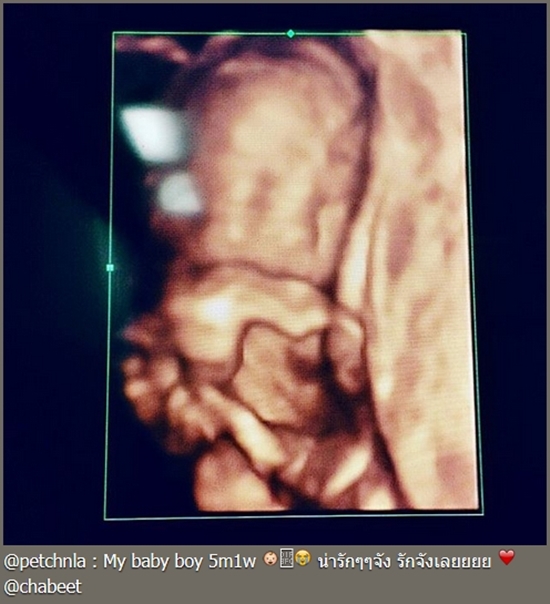 เพชร นาระ เพชร นาระ