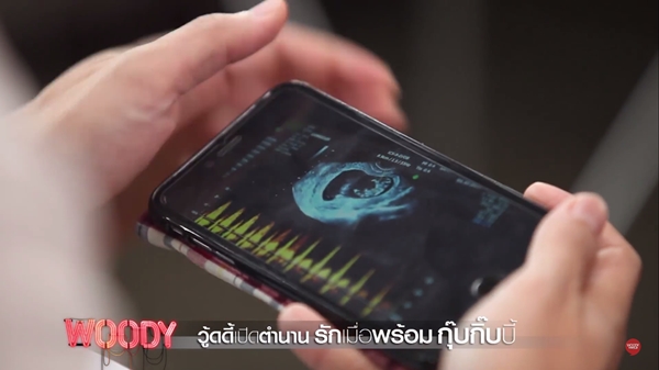 กุ๊บกิ๊บ บี้ kpn กุ๊บกิ๊บ บี้ kpn