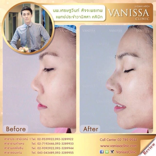 เอมมี่ อมลวรรณ เอมมี่ อมลวรรณ