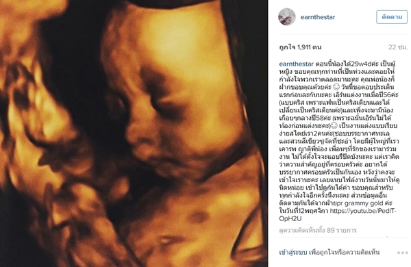 งานแต่งงานเอิร์น เดอะสตาร์ งานแต่งงานเอิร์น เดอะสตาร์