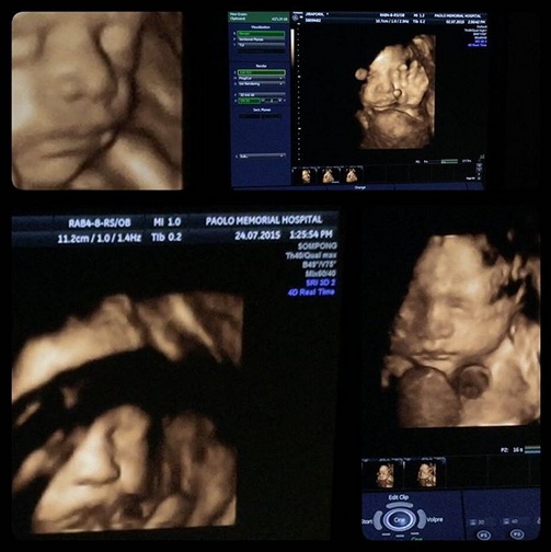 เอ พศิน เผยโฉม น้องแตงกวา ภรรยาคนรู้ใจ เอ พศิน เผยโฉม น้องแตงกวา ภรรยาคนรู้ใจ