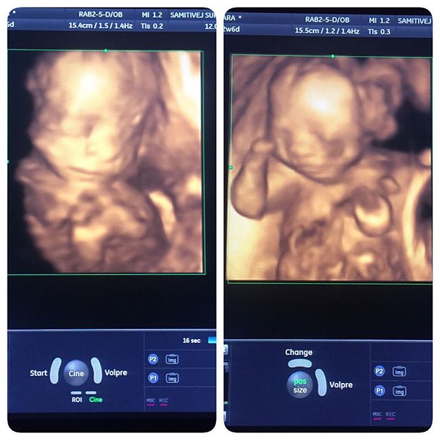 โอปอล์ หมอโอ๊ค โอปอล์ หมอโอ๊ค