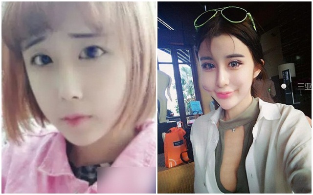 เน็ตไอดอลจีนทำศัลยกรรม เน็ตไอดอลจีนทำศัลยกรรม