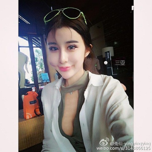 เน็ตไอดอลจีนทำศัลยกรรม เน็ตไอดอลจีนทำศัลยกรรม