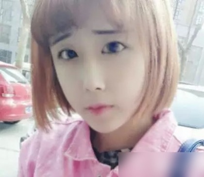 เน็ตไอดอลจีนทำศัลยกรรม เน็ตไอดอลจีนทำศัลยกรรม