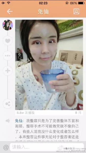 เน็ตไอดอลจีนทำศัลยกรรม เน็ตไอดอลจีนทำศัลยกรรม