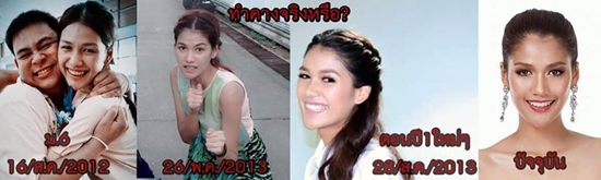 แนท อนิพรณ์ มิสยูนิเวิร์สไทยแลนด์ 2015 ถูกจับผิดทำศัลยกรรม ? แนท อนิพรณ์ มิสยูนิเวิร์สไทยแลนด์ 2015 ถูกจับผิดทำศัลยกรรม ?