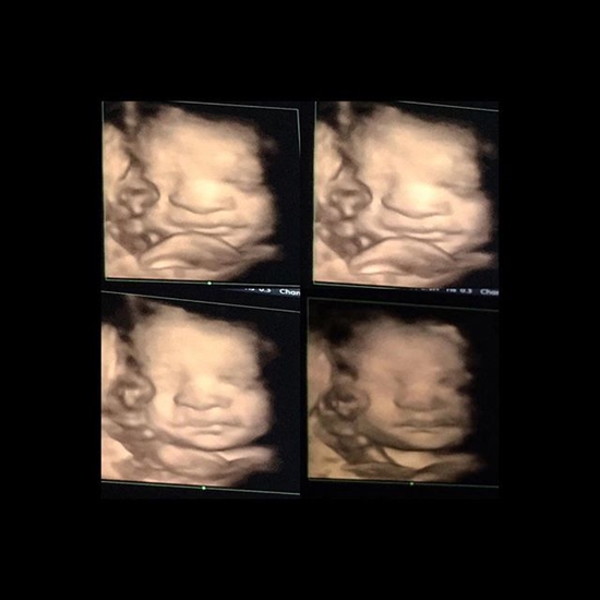 ซี ฉัตรปวีณ์ ซี ฉัตรปวีณ์