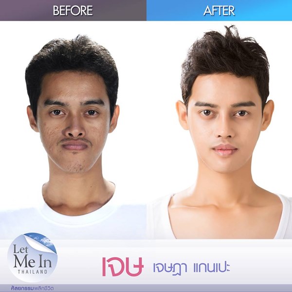 เจษ เจษฎา Let Me In Thailand ผู้ชายคนแรก เจษ เจษฎา Let Me In Thailand ผู้ชายคนแรก