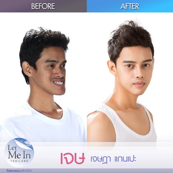 เจษ เจษฎา Let Me In Thailand ผู้ชายคนแรก เจษ เจษฎา Let Me In Thailand ผู้ชายคนแรก