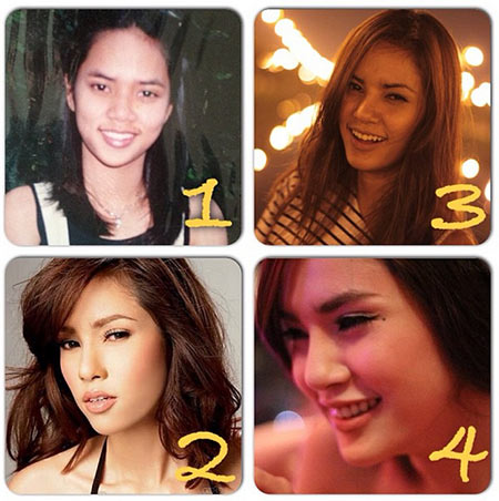 อุ้ม ลักขณา ศัลยกรรม อุ้ม ลักขณา ศัลยกรรม