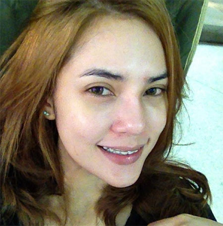 อุ้ม ลักขณา ศัลยกรรม อุ้ม ลักขณา ศัลยกรรม