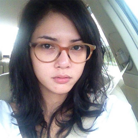 อุ้ม ลักขณา ศัลยกรรม อุ้ม ลักขณา ศัลยกรรม