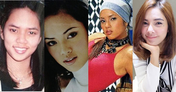 อุ้ม ลักขณา ศัลยกรรม อุ้ม ลักขณา ศัลยกรรม