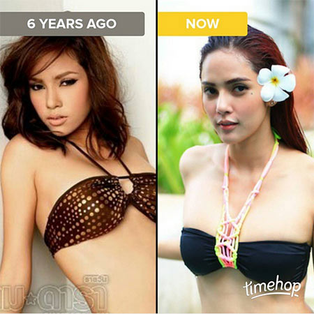 อุ้ม ลักขณา ศัลยกรรม อุ้ม ลักขณา ศัลยกรรม