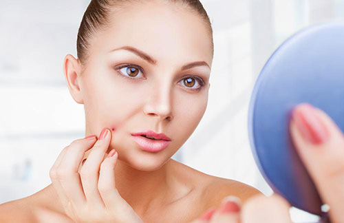 สิวขึ้นที่แก้ม สาเหตุ สิวขึ้นที่แก้ม สาเหตุ