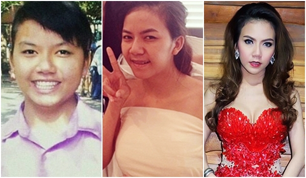 จ๊ะ อาร์สยาม ศัลยกรรม จ๊ะ อาร์สยาม ศัลยกรรม