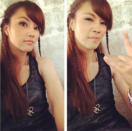 กุญแจซอล ศัลยกรรม กุญแจซอล ศัลยกรรม