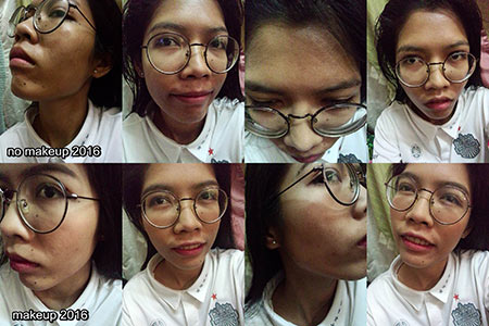 วิธีรักษาสิว วิธีรักษาสิว