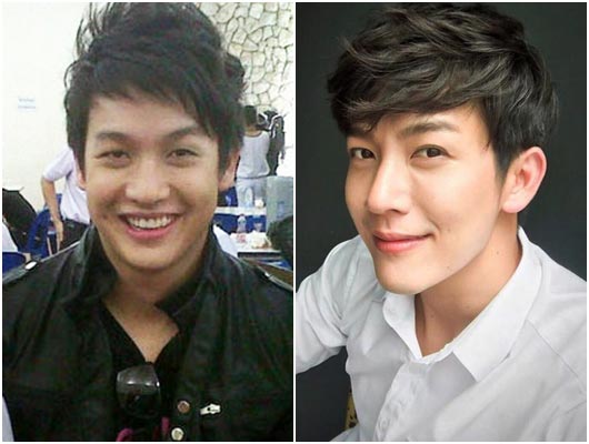 ดาราชายศัลยกรรม ดาราชายศัลยกรรม