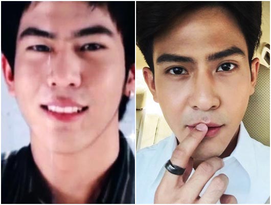 ดาราชายศัลยกรรม ดาราชายศัลยกรรม