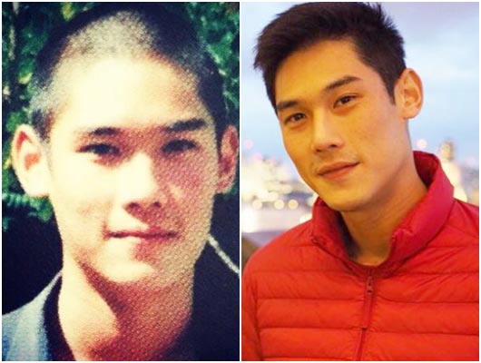 ดาราชายศัลยกรรม ดาราชายศัลยกรรม