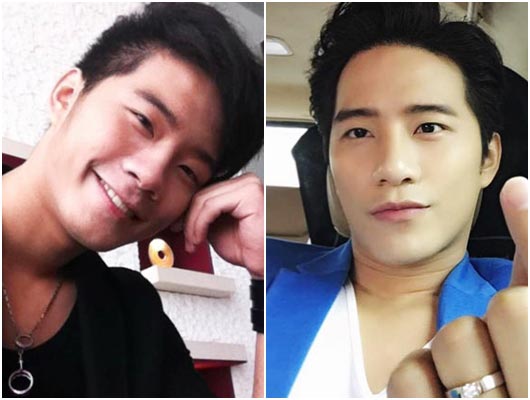 ดาราชายศัลยกรรม ดาราชายศัลยกรรม