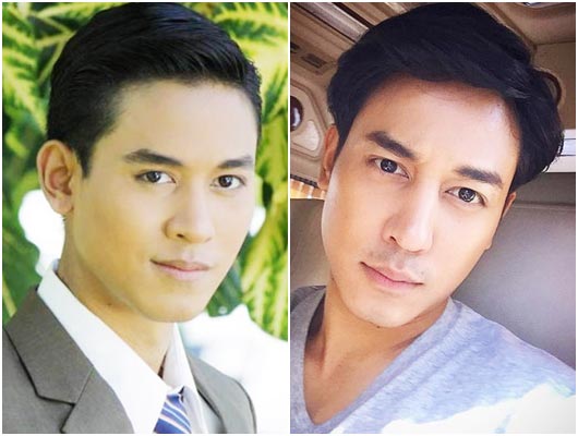 ดาราชายศัลยกรรม ดาราชายศัลยกรรม