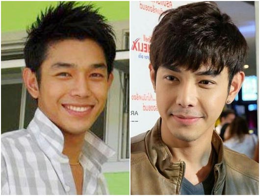 ดาราชายศัลยกรรม ดาราชายศัลยกรรม