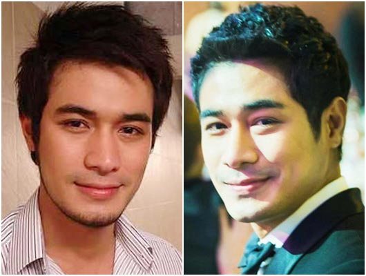 ดาราชายศัลยกรรม ดาราชายศัลยกรรม