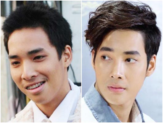 ดาราชายศัลยกรรม ดาราชายศัลยกรรม