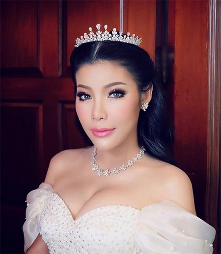 แหวนแหวน ศัลยกรรม แหวนแหวน ศัลยกรรม