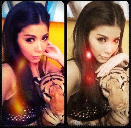 แหวนแหวน ศัลยกรรม แหวนแหวน ศัลยกรรม