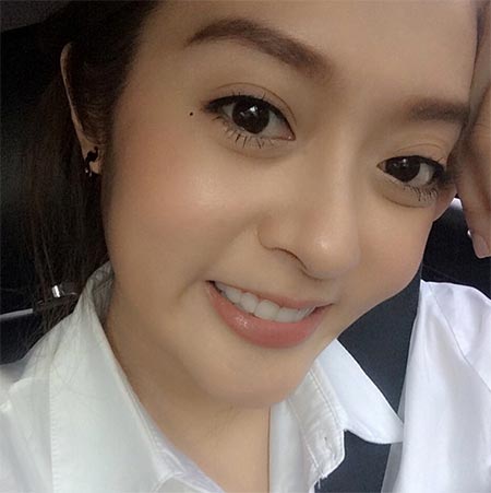 แก้มบุ๋ม แก้มบุ๋ม