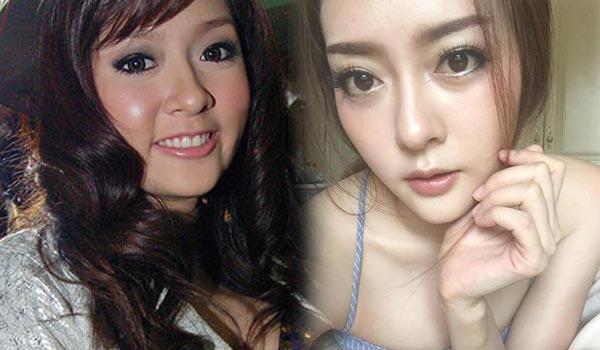 แก้มบุ๋ม แก้มบุ๋ม