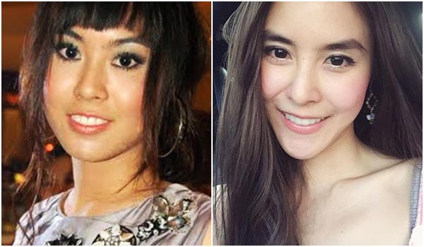 พีค ภัทรศยา ศัลยกรรม พีค ภัทรศยา ศัลยกรรม